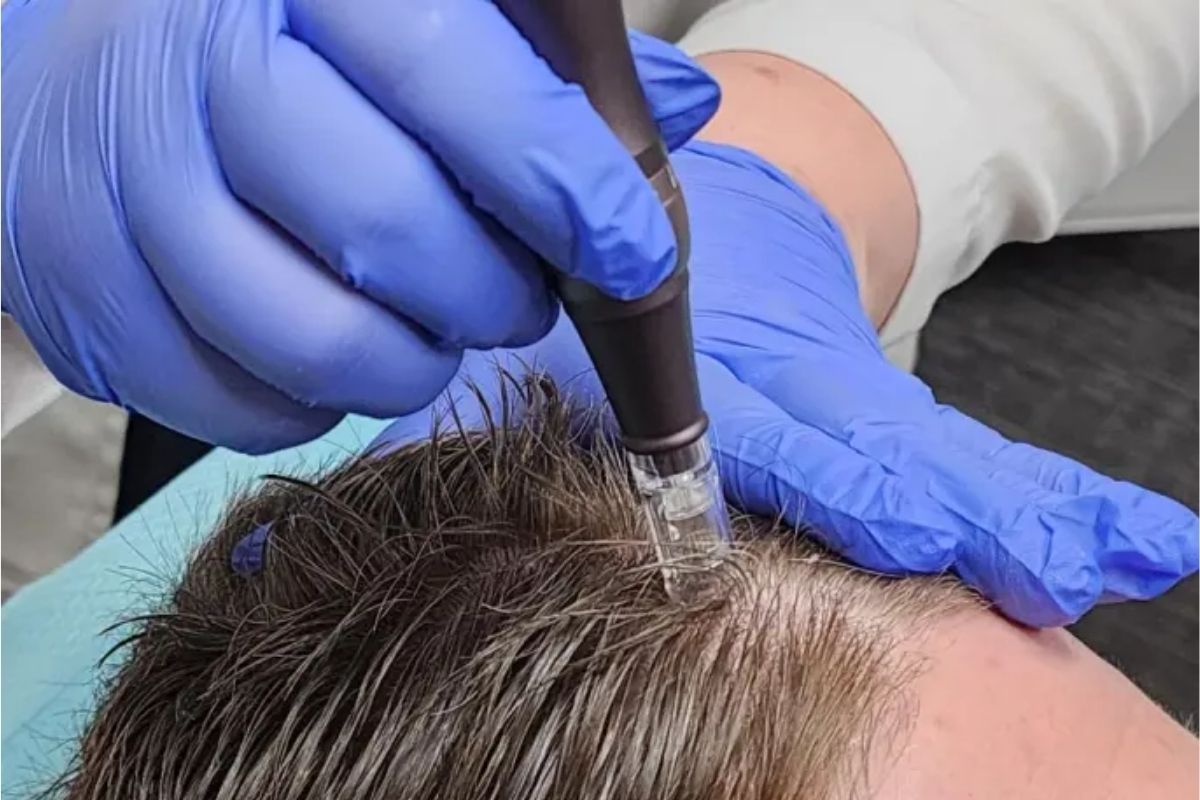 scalp care - chăm sóc da đầu - nam giới - head spa - luxuo 7